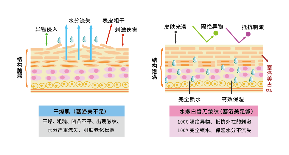 乾燥肌とシワのない潤う皮膚の比較